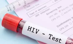 Pozitif-İz Derneği açıkladı: Türkiye'de HIV vakaları artıyor!