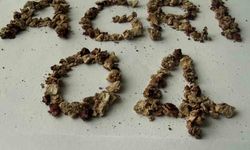 Ağrı'da zorlu taş cerrahisi başarıyla gerçekleştirildi