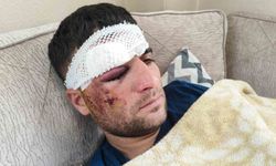 Döner ustası motosiklet sürücüsü: 'Kaza sonrası kaçıp gittiler'