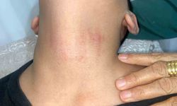 Küçükçekmece'de kadın memurun 10 yaşındaki öğrenciyi okulda darbettiği iddiası