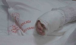 Üzerine kaynar su dökülen bebeğin vücudunun yüzde 27'si yandı