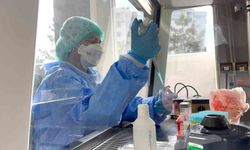 Eskişehir'de düzey III Tüberküloz Laboratuvarı açılıyor