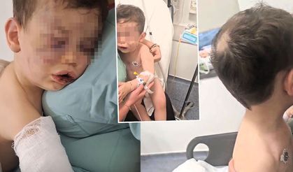 Denizli'de 2 yaşındaki bebek, annesinin sevgilisi tarafından dövüldü