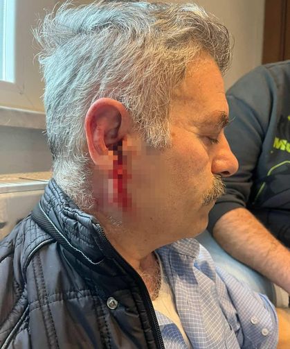 Silivri'de özel bakım merkezine çağrılan eski çalışan darbedildi