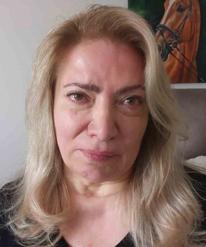 Güzellik merkezinde estetik operasyonu yüz felci yaptı