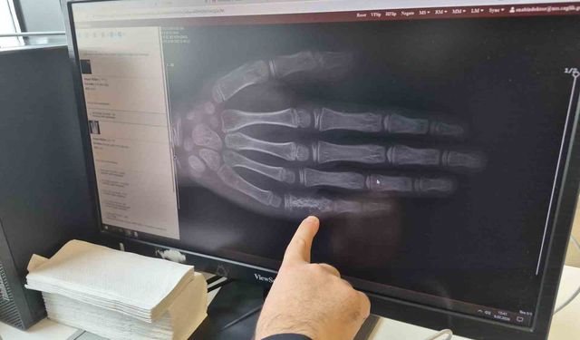 Eskişehir'de her ay 5 ila 7 çocuğa kanser tanısı konuluyor