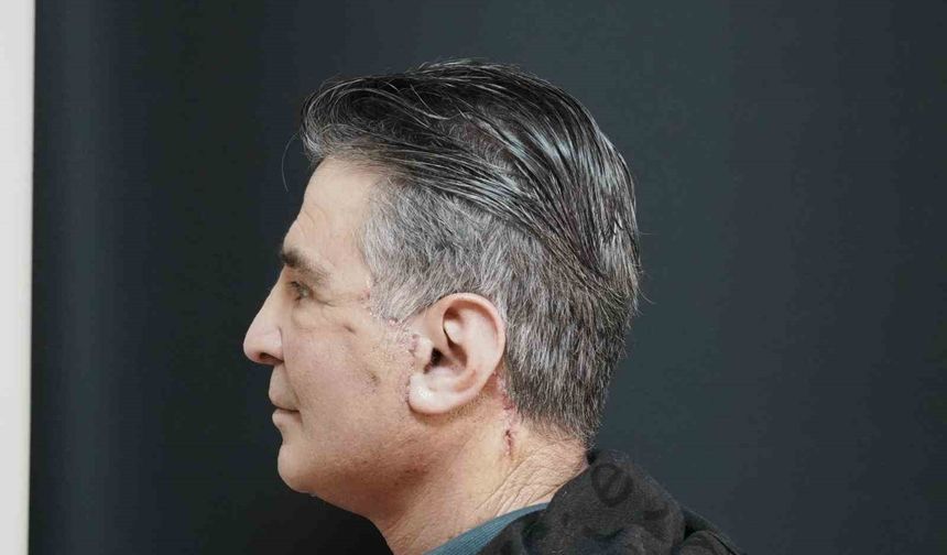 Bitlis'te ilk defa yüz germe ameliyatı başarıyla yapıldı