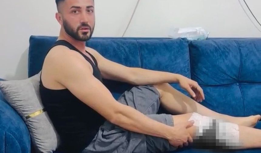 Nizip'te başıboş köpek saldırısında yaralanan 2 kişi belediyeye tepki gösterdi