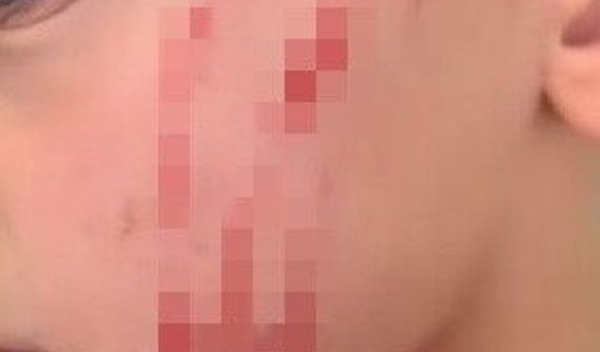 Van'da sokakta oynayan çocuğa saldırı: O anlar kamerada